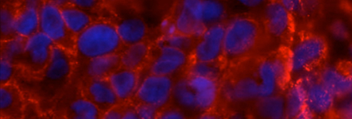 paraffin-embedded-tissue